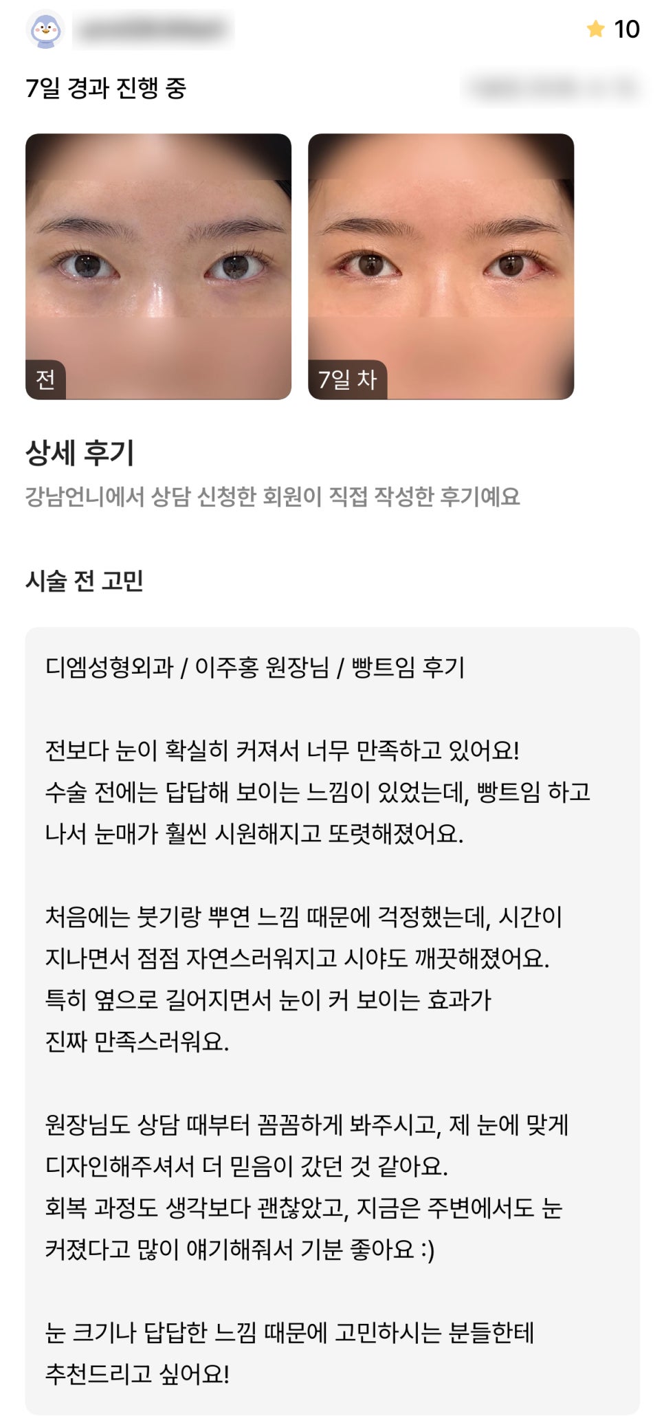 DM Lower Outer Eye Corner Surgery Review, “The effect of making my eyes look bigger is really satisfying!” image 1