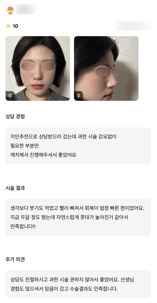 디엠 코성형 후기, “자연스럽게 콧대가 높아진 거 같아서 만족합니다!” 관련 이미지 1