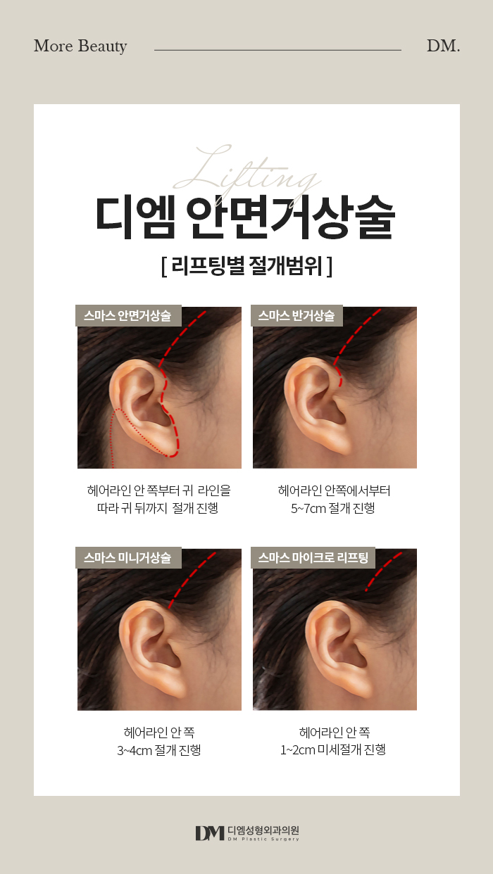 반거상, 흉터걱정은 덜고 리프팅 효과는 올리고! 관련 이미지 9