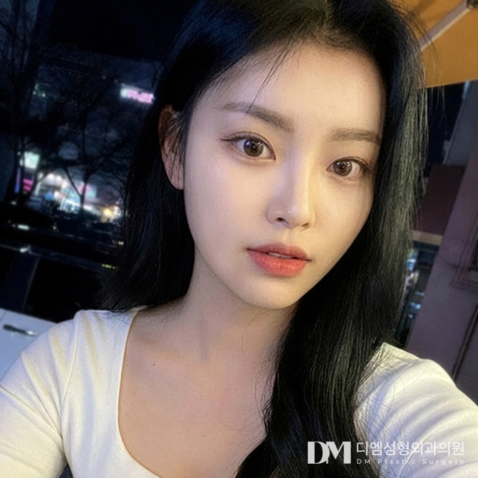 디엠 뒤밑트임 전후사진, 가로 길이 확실히 늘려준 비결! 관련 이미지 3