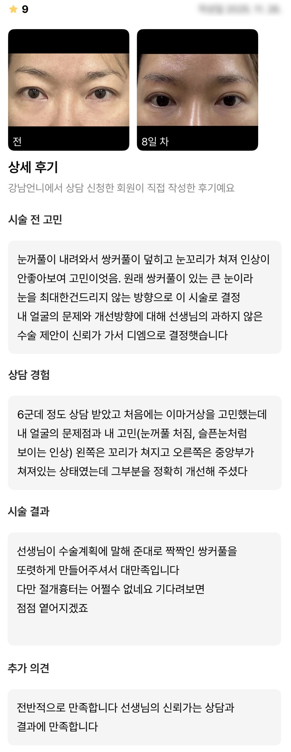 DM Brow Lift Surgery Review, “I’m satisfied with the doctor’s trustworthy consultation and the results!” image 1