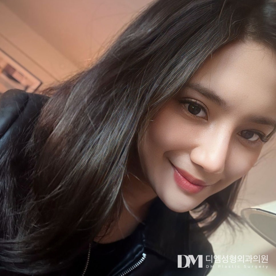 눈매교정, 자연스럽게 또렷해지기 관련 이미지 1