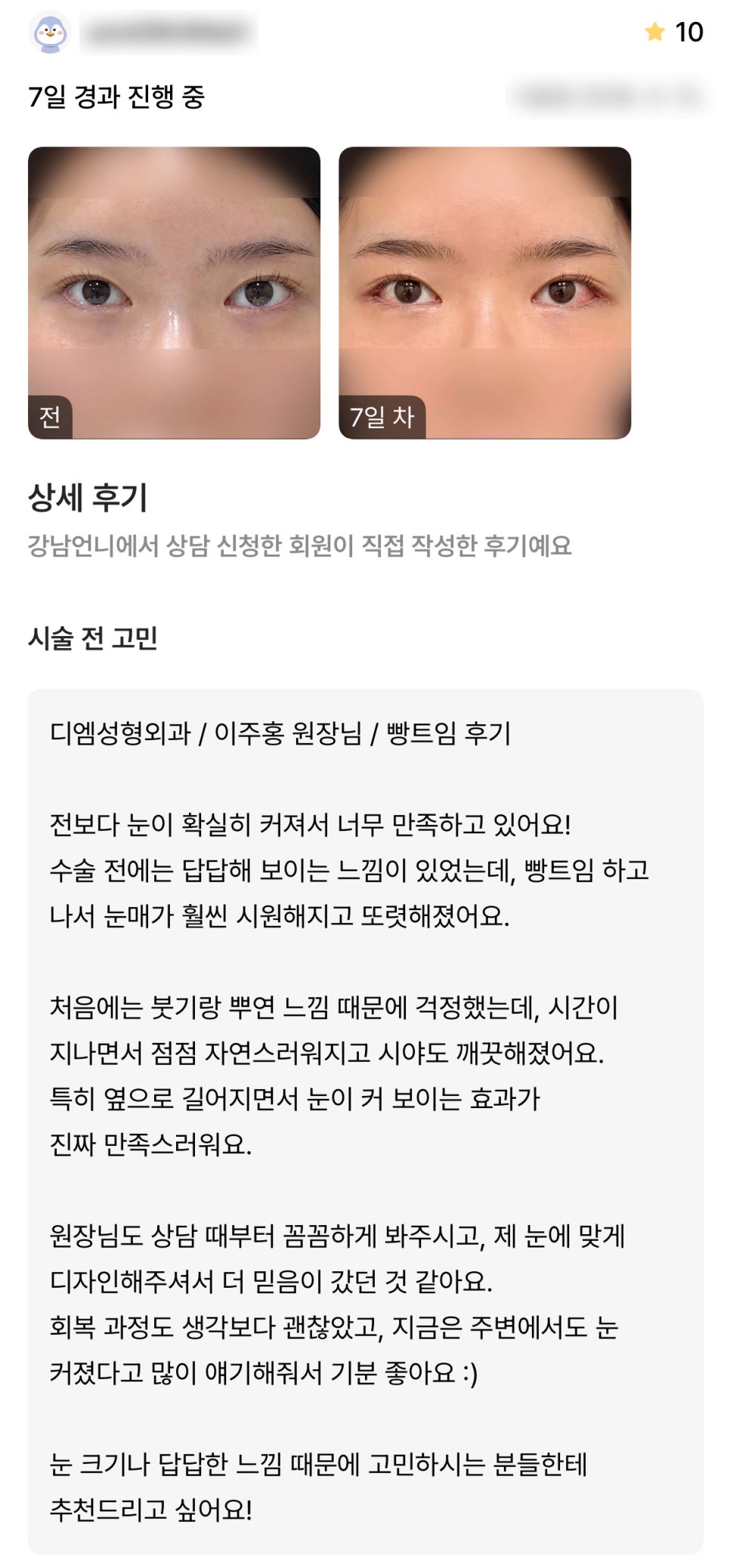 디엠 뒤밑트임/트임성형 후기, “눈매가 훨씬 시원해지고 또렷해졌어요!” 관련 이미지 1