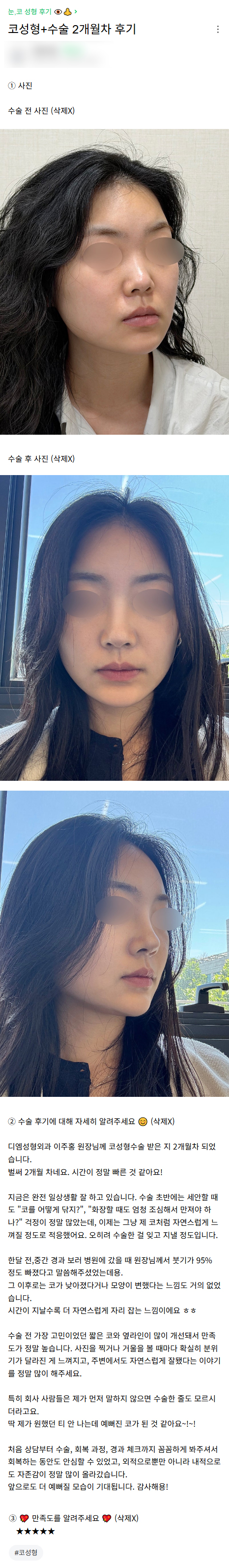 디엠 낮은코성형 후기, &ldquo;앞으로 더 예뻐질 모습이 기대됩니다!&rdquo; 관련 이미지 1