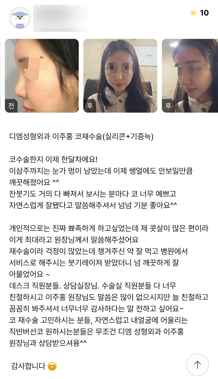 Revision Rhinoplasty Review. “I feel so, so happy that everyone says my nose turned out so pretty and natural ^^” image 1