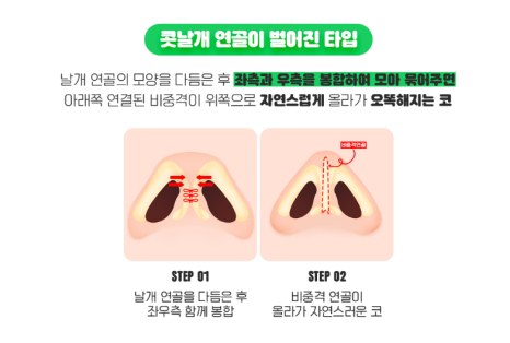 복코성형, 둔해보이는 인상에서 세련된 인상으로! 관련 이미지 7