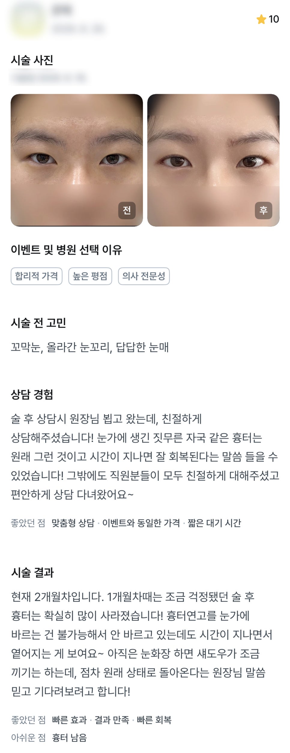 디엠 빵트임/트임성형 후기, &ldquo;원장님, 직원분들이 모두 친절하게 대해주셨어요!&rdquo; 관련 이미지 1