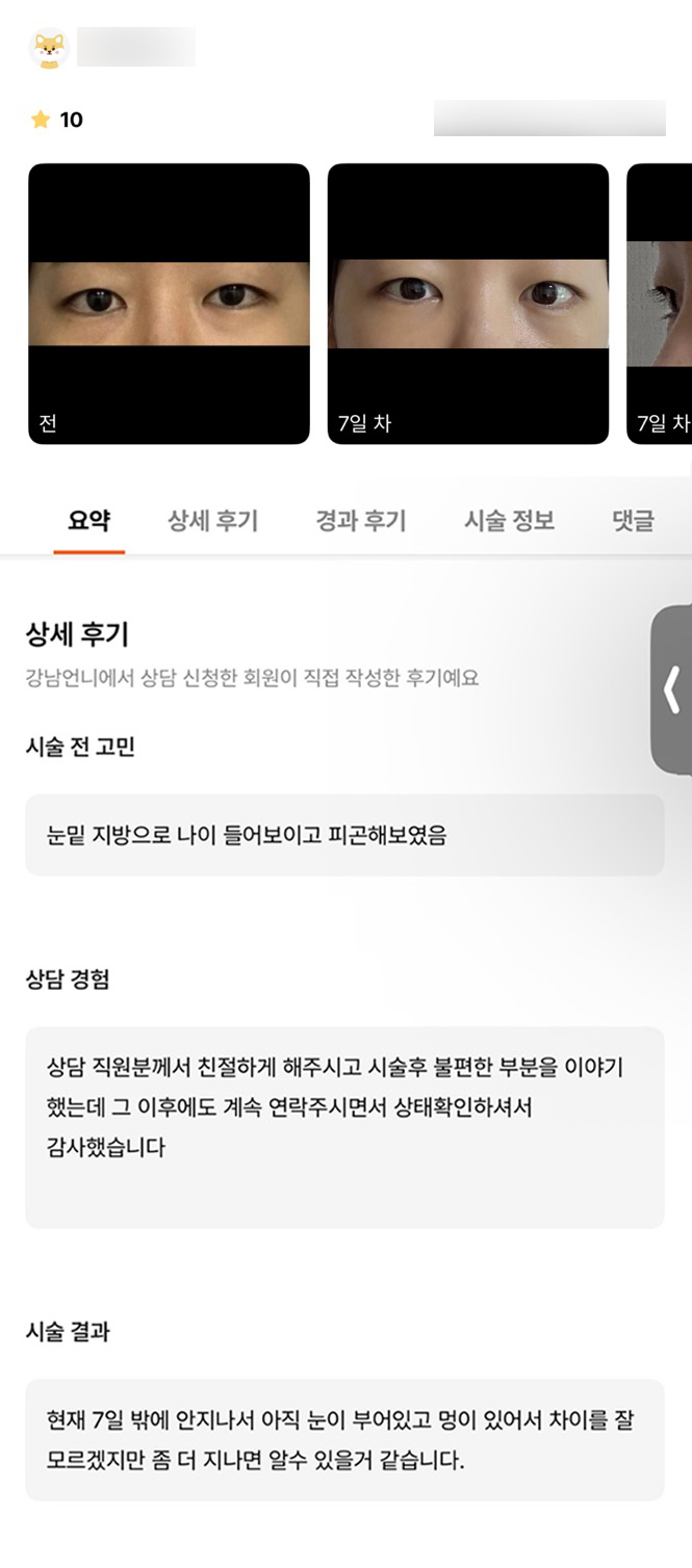 눈밑지방재배치 후기."수술 후 친절한 응대가 좋아요" 관련 이미지 1