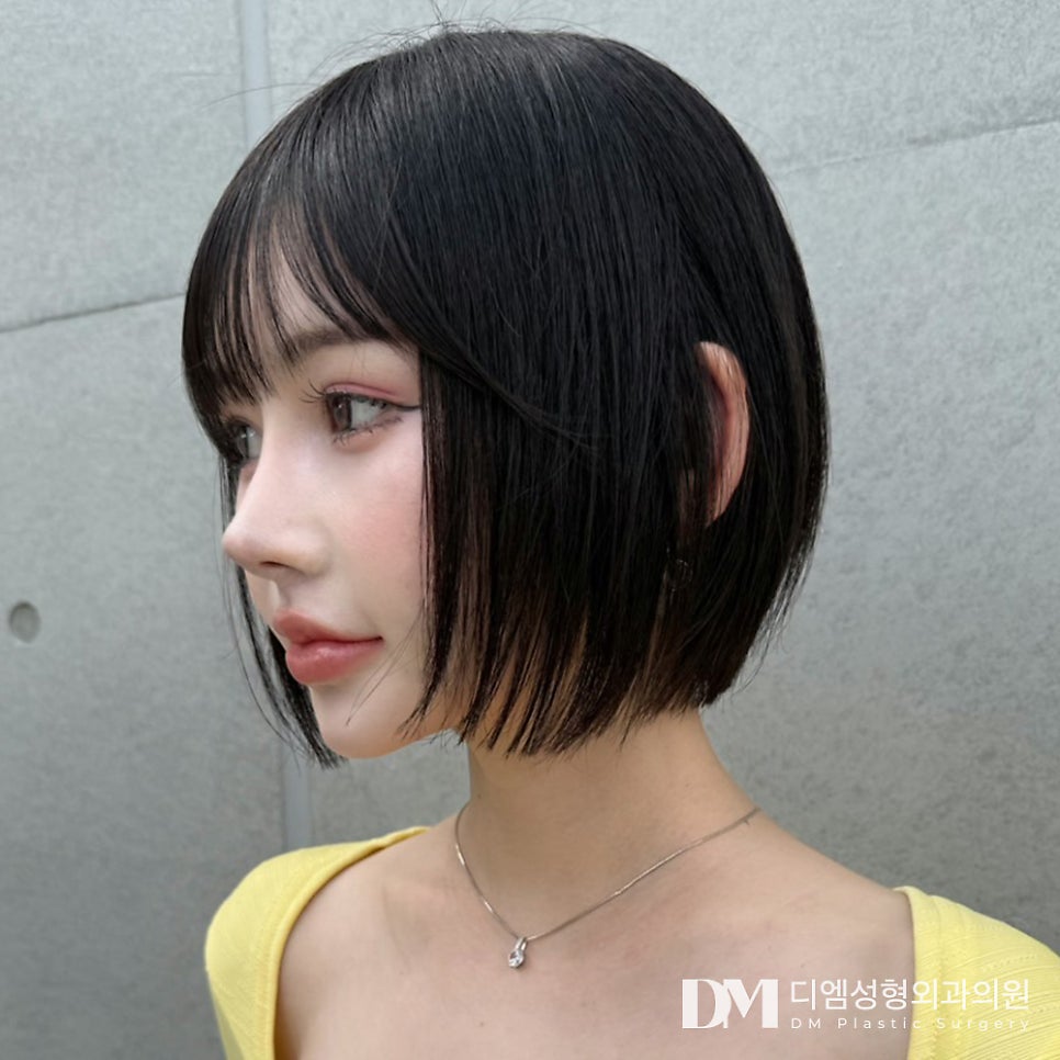 동양인에 흔한 짧은코 수술방법과 주의해야 할 점은? 관련 이미지 1