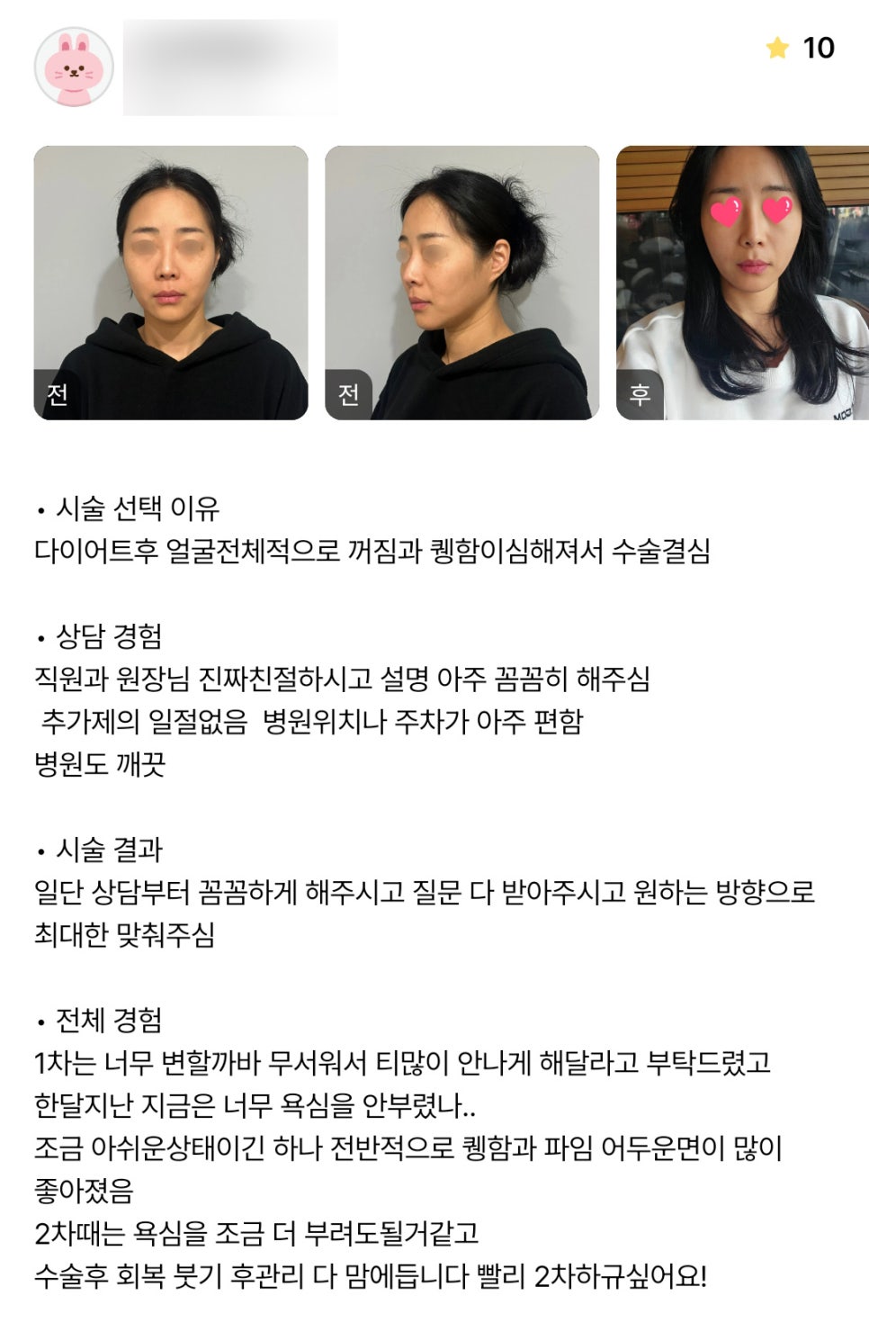 얼굴지방이식 후기."전반적으로 잘 개선되어서 2차 빨리 하고싶어요!" 관련 이미지 1