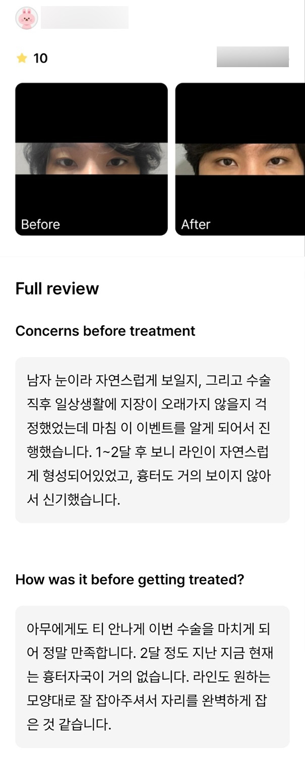 눈재수술 후기." 라인도 원하는 모양대로 잘 잡아주셔서 자리를 완벽하게 잡은 것 같습니다." 관련 이미지 1