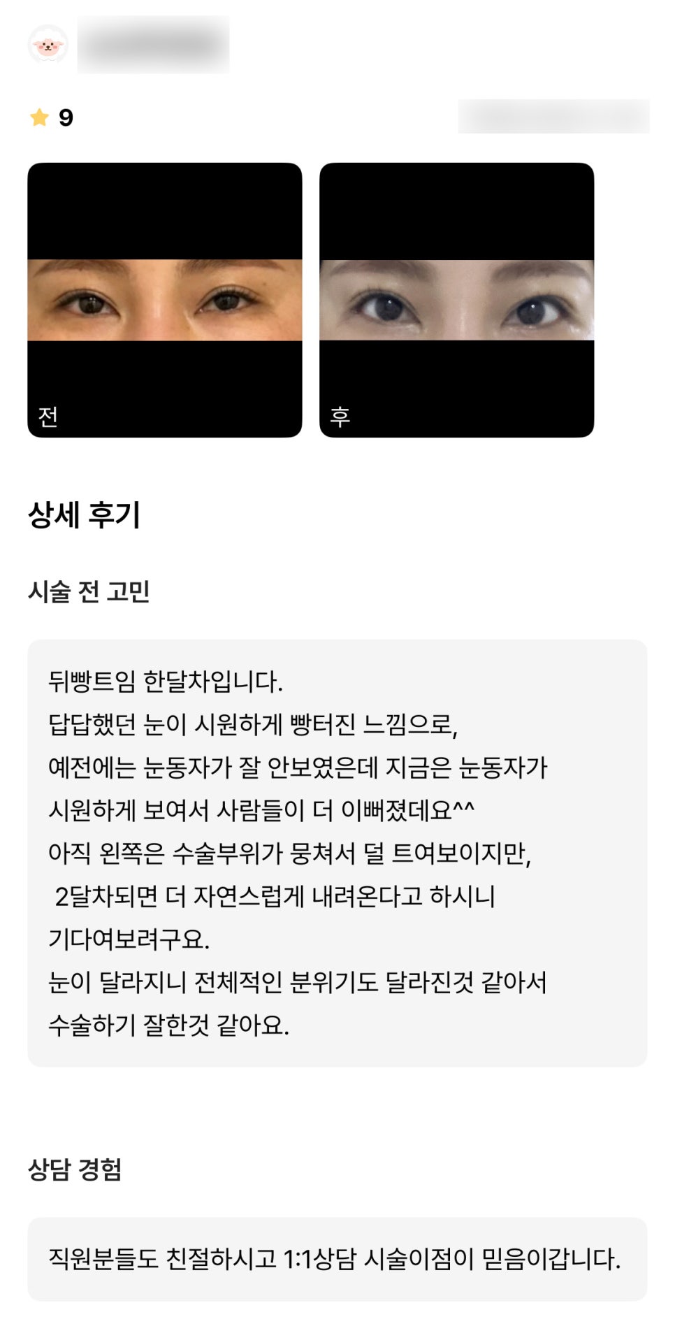 빵트임 후기."눈이 달라지니 전체적인 분위기도 달라진 것 같아서 수술하기 잘한 것 같아요." 관련 이미지 1