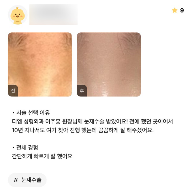 눈재수술 후기."꼼꼼하고 빠르게 잘 해주셨어요!" 관련 이미지 1