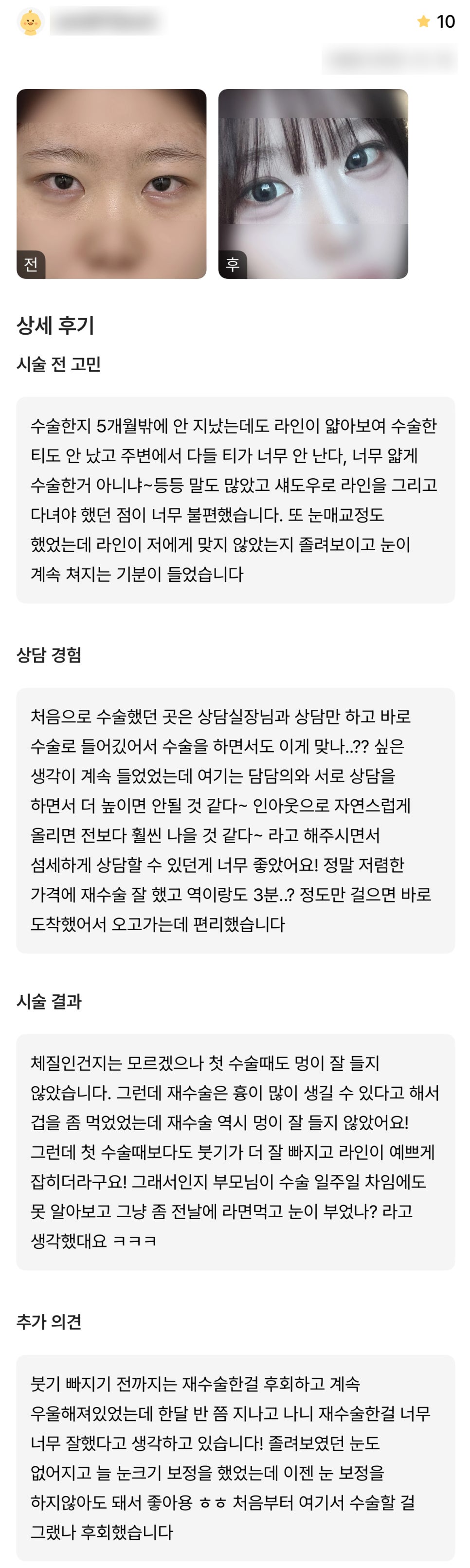 디엠 눈재수술 수술후기, &ldquo;처음부터 여기서 수술할 걸 그랬나 후회했어요!&rdquo; 관련 이미지 1