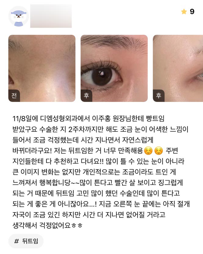 빵트임 후기."너무 만족하고 주변에 추천하고 다녀요!" 관련 이미지 1