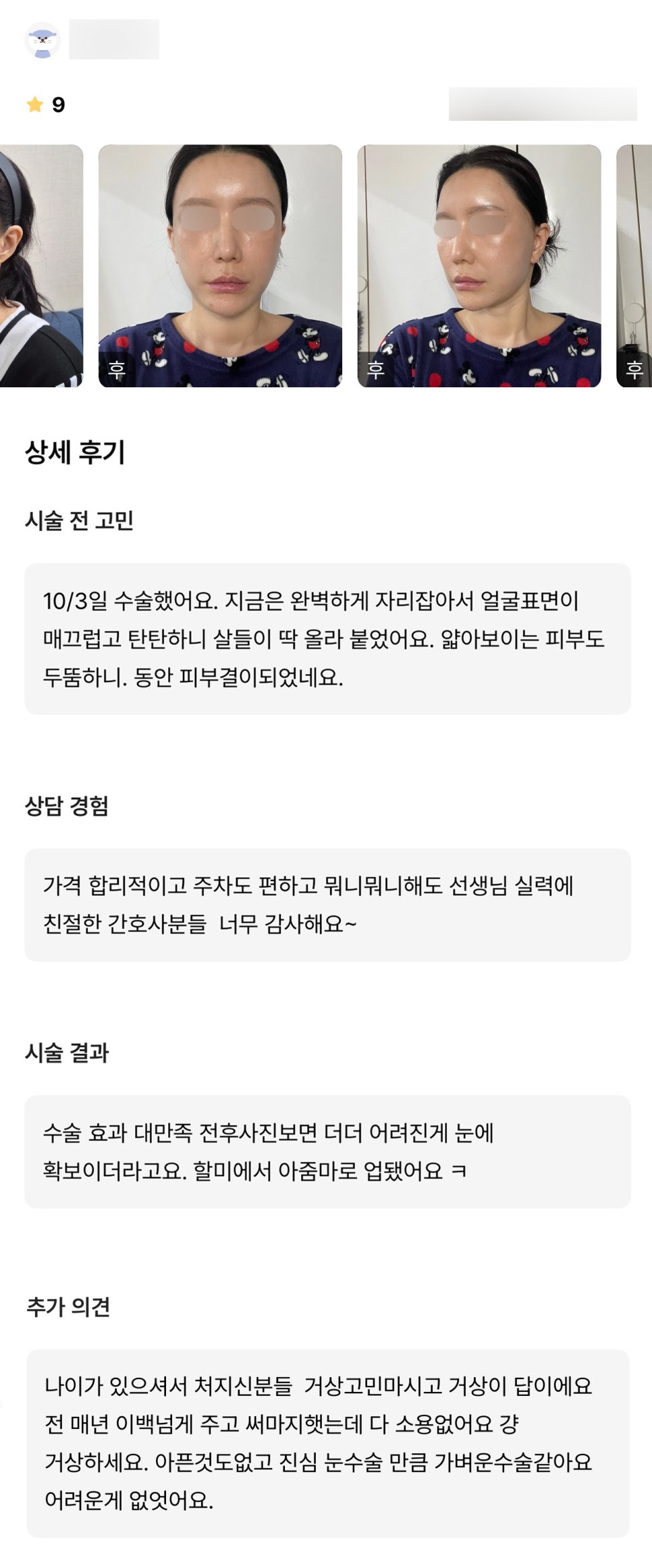 안면거상 후기."안면거상 대만족이에요!" 관련 이미지 1