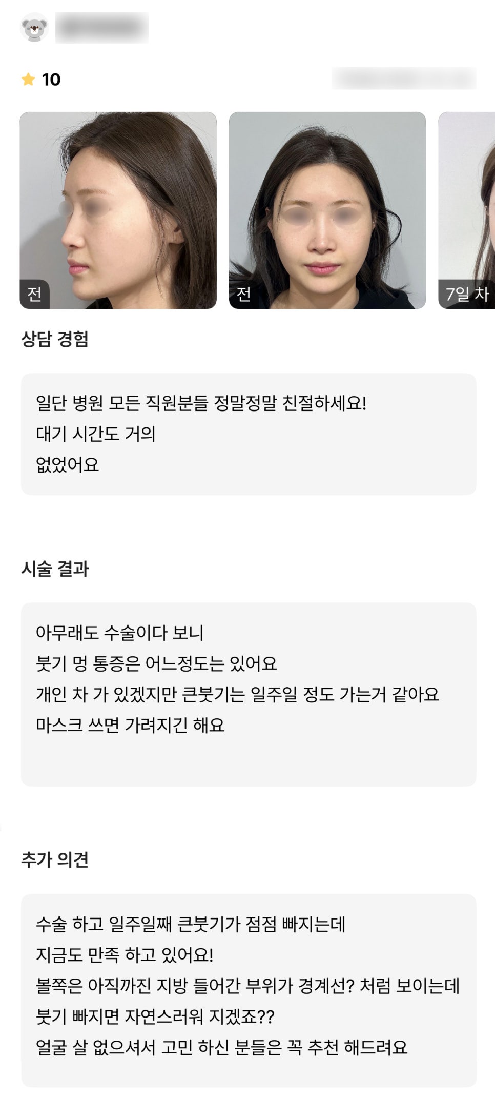 얼굴지방이식 후기."얼굴 살 없으셔서 고민이신 분들은 꼭 추천드려요" 관련 이미지 1