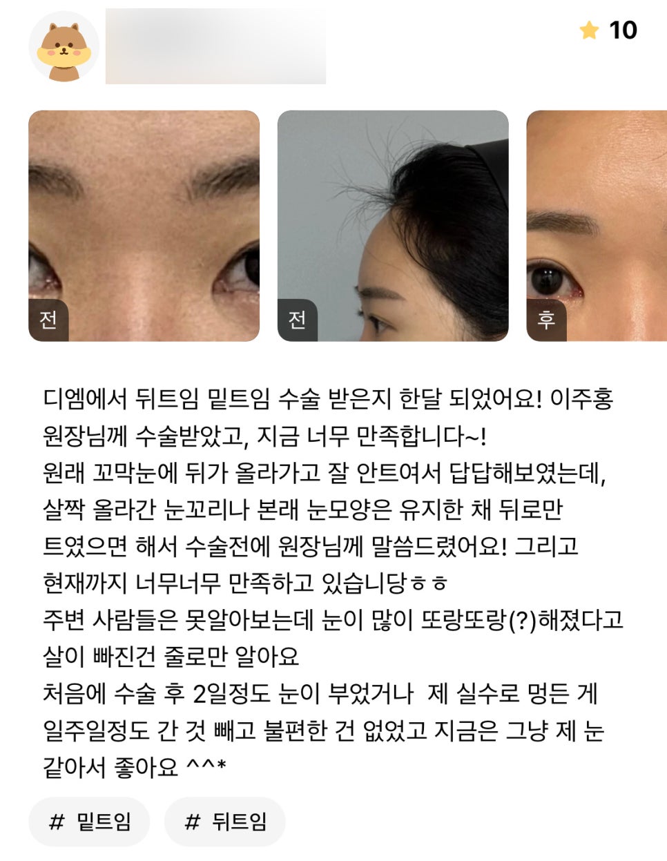 빵트임 후기."1개월차인데 그냥 제 눈 같아서 좋아요!" 관련 이미지 1