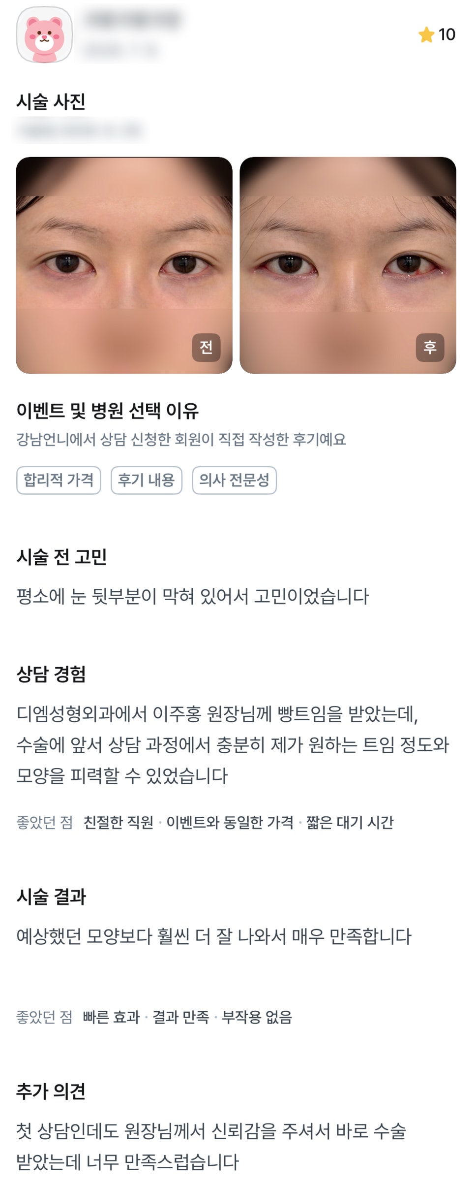 디엠 뒤밑트임 수술후기, “예상보다 더 잘 나와서 매우 만족합니다!” 관련 이미지 1