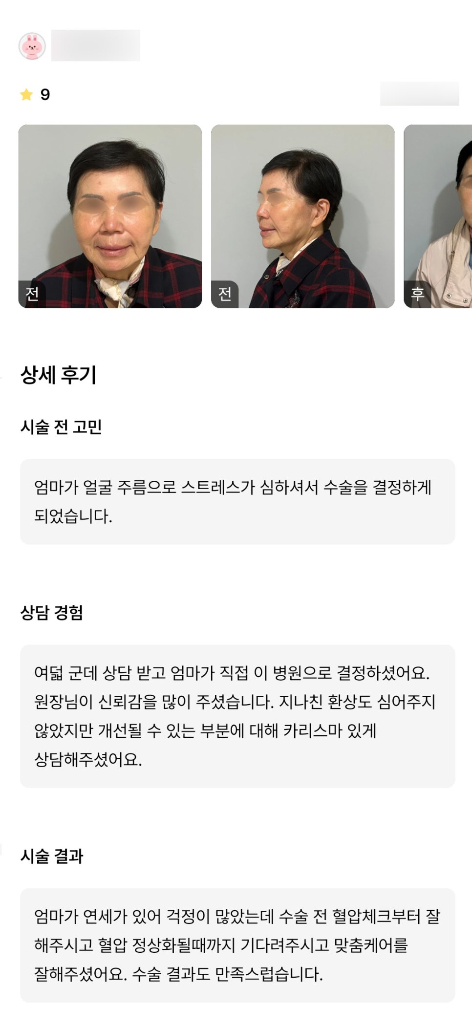 안면거상 후기."맞춤 케어가 좋았고 수술 결과가 만족스러워요!" 관련 이미지 1