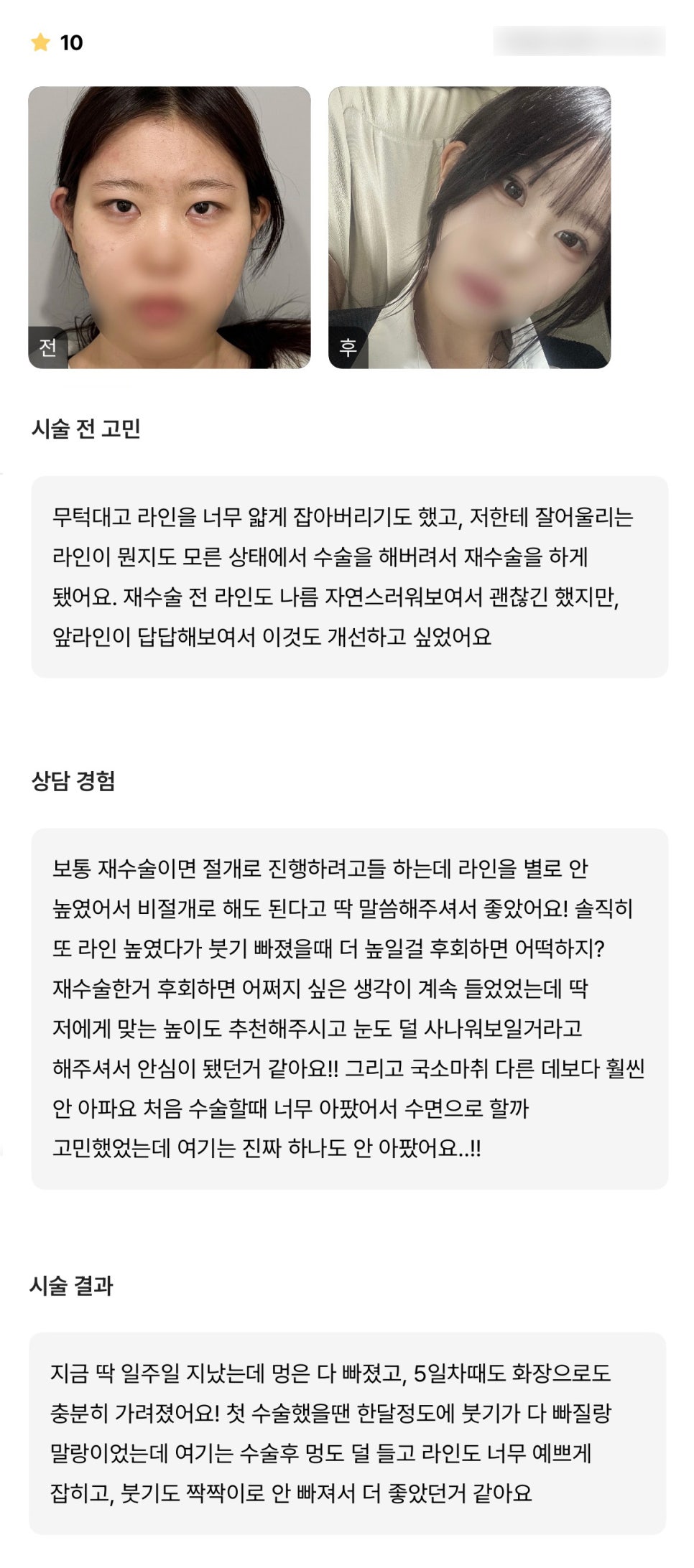 Double Eyelid Revision Surgery Review. "After the surgery, I had less bruising, the line was set so beautifully, and the swelling didn't go down unevenly, which I think made it even better." image 1