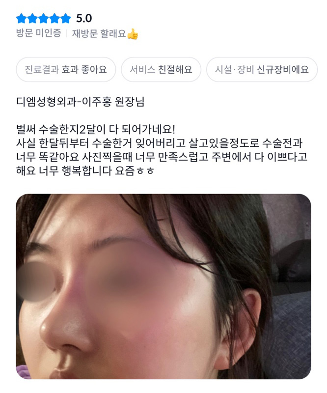 Rhinoplasty Review. “Everyone around me says I’m pretty, I’m so happy these days!” image 1