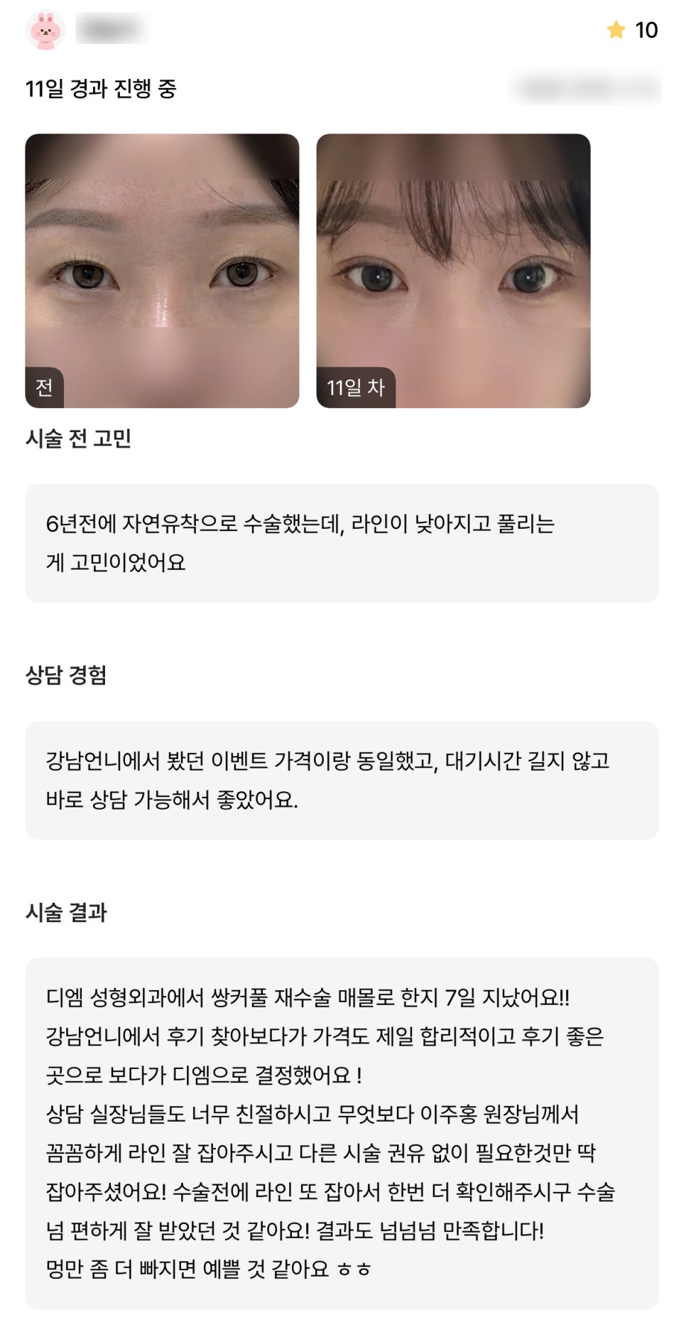 디엠 눈재수술 후기, “결과 넘넘넘 만족합니다!” 관련 이미지 1