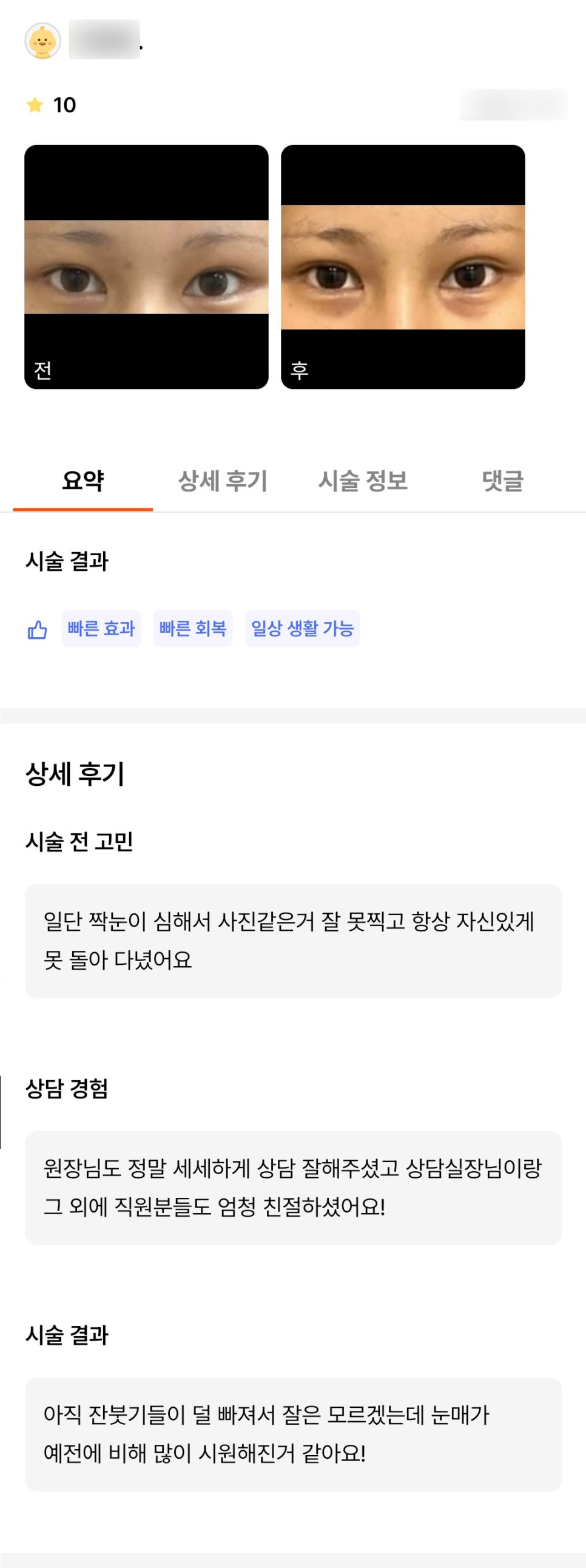 눈재수술 후기." 눈매가 예전에 비해 많이 시원해진 것 같아요 ! " 관련 이미지 1