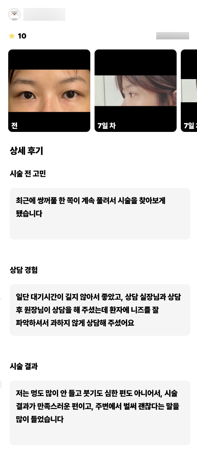 눈재수술 후기."주변에서 일주일만에 벌써 괜찮다는 말을 많이 들었어요!" 관련 이미지 1