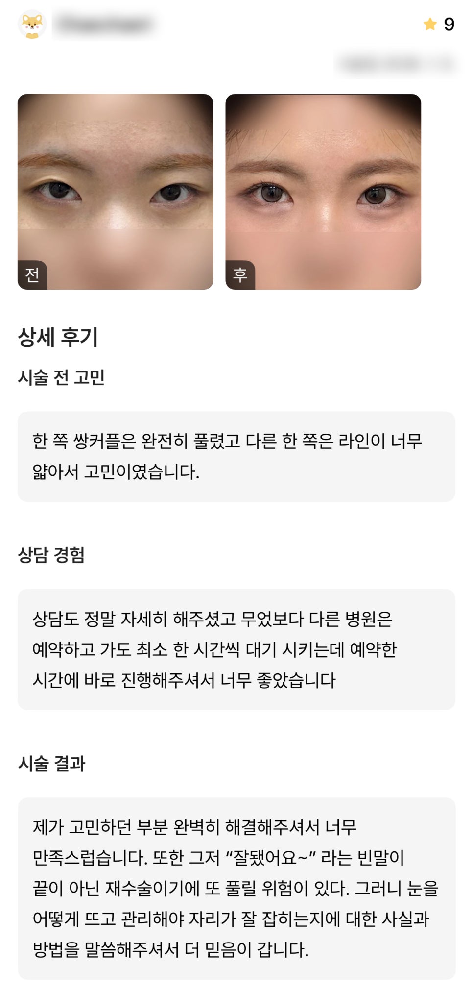 디엠 눈재수술 후기, &ldquo;고민하던 부분을 해결해 주셔서 너무 만족스러워요!&rdquo; 관련 이미지 1