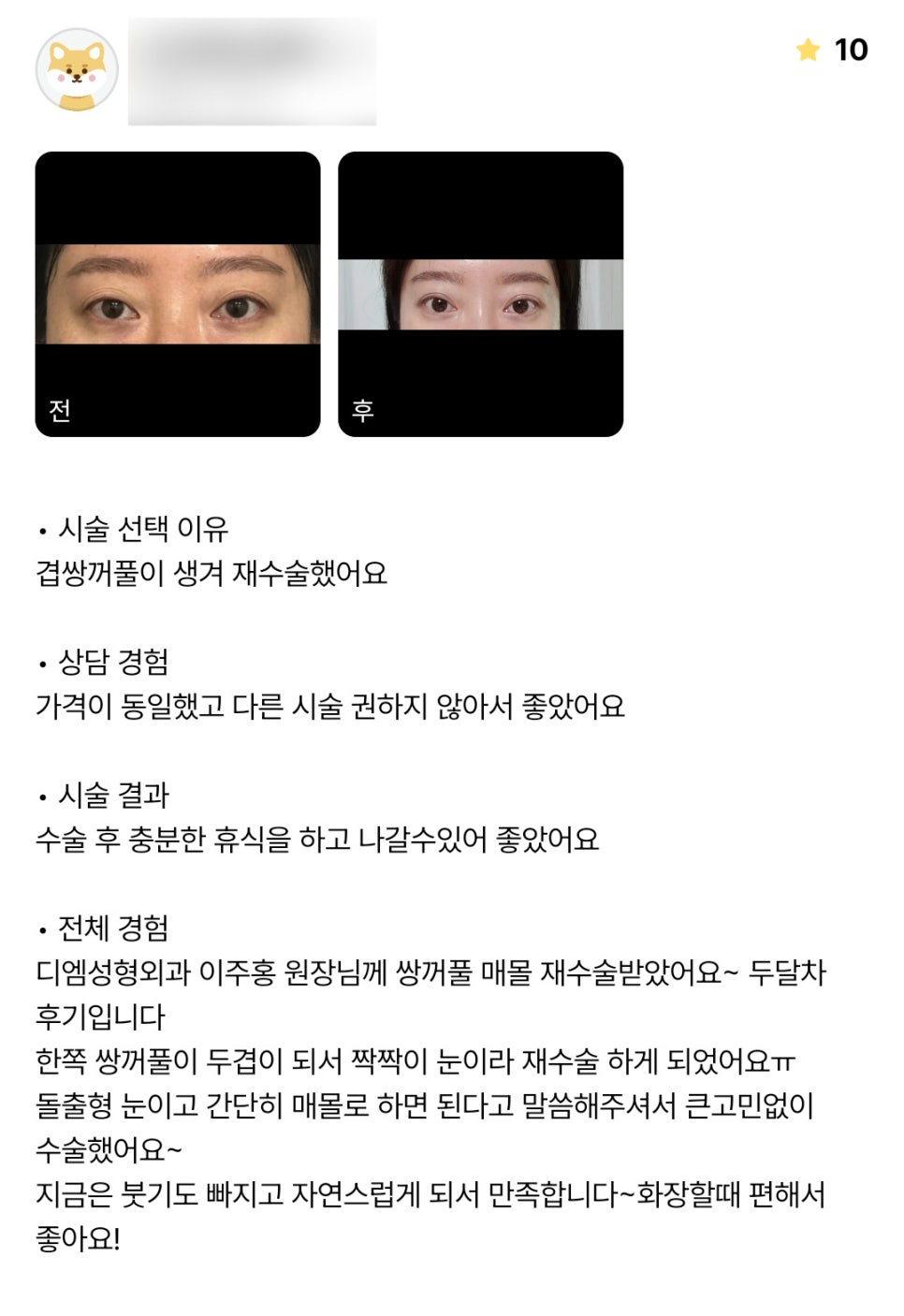 Revision Double-Eyelid Surgery Review: “I’m Satisfied Because It Looks Natural~ It’s Nice That Applying Makeup Is Easier!” image 1