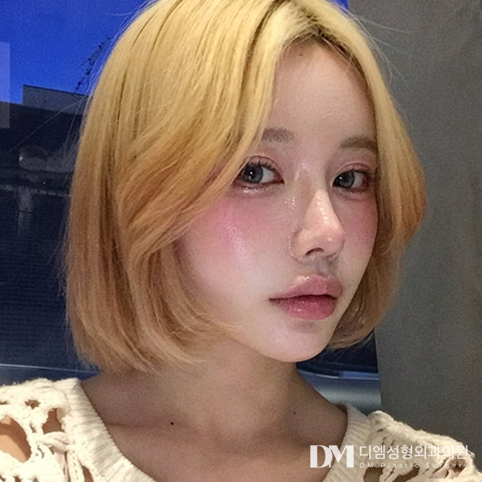 눈재수술 전, 반드시 알아야 할 핵심 포인트! 관련 이미지 1