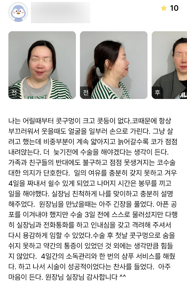 Rhinoplasty Review. "I heard praise that the surgery was a success, and I’m very happy with it!" image 1