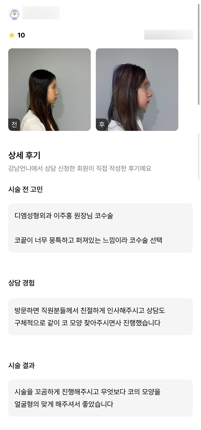 코성형 후기."꼼꼼하고 코의 모양을 얼굴에 맞게 해주셔서 좋았어요!" 관련 이미지 1