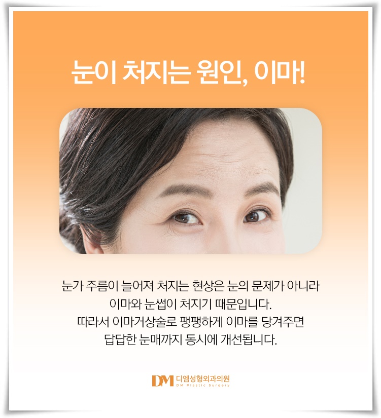 이마거상, 이마 주름과 처진 눈매를 한번에 교정하고 싶다면? 관련 이미지 4