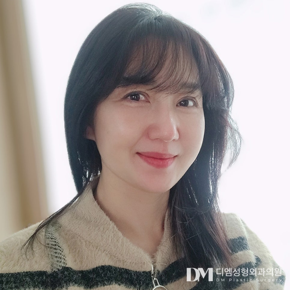 디엠 안면거상 전후사진, 잃어버린 젊음을 되찾을 수 있는 리프팅 관련 이미지 1