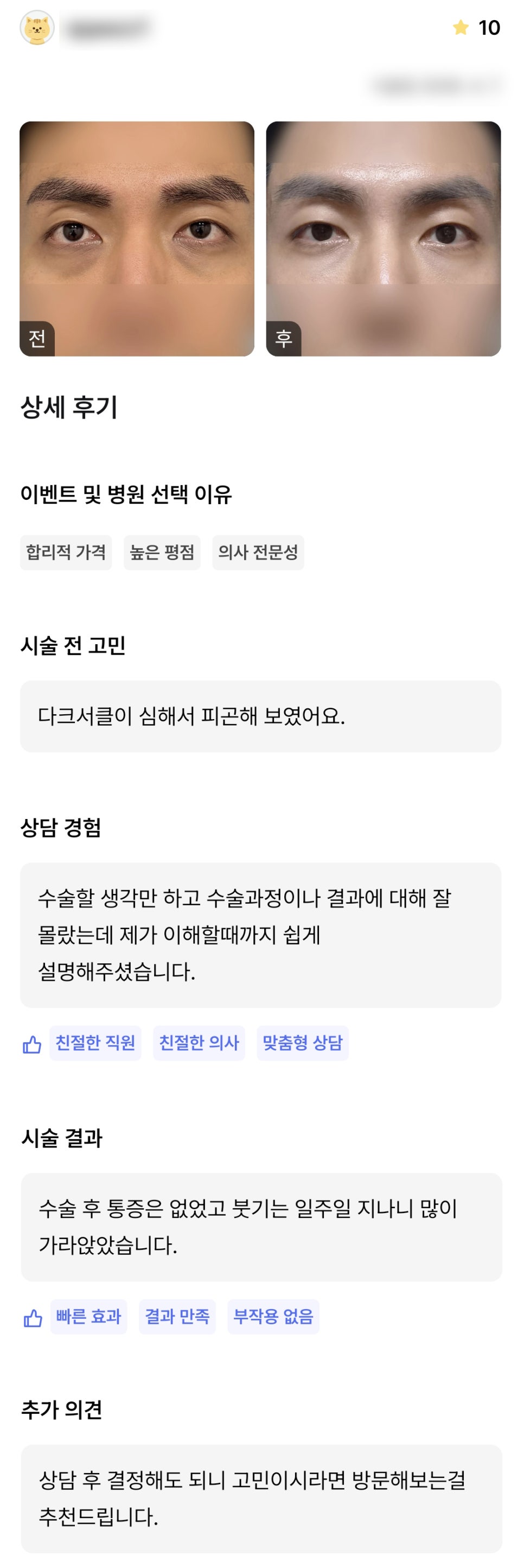 디엠 눈밑지방재배치 수술후기, “이해할 때까지 쉽게 설명해주셨습니다!” 관련 이미지 1
