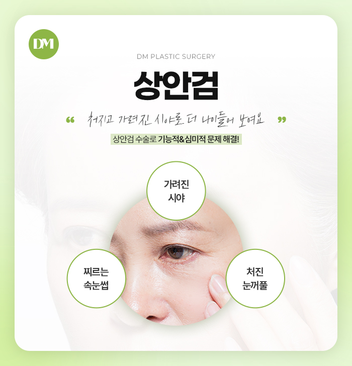 Escape Drooping Eyes and Renew Your Eye Area for a More Youthful Look image 2