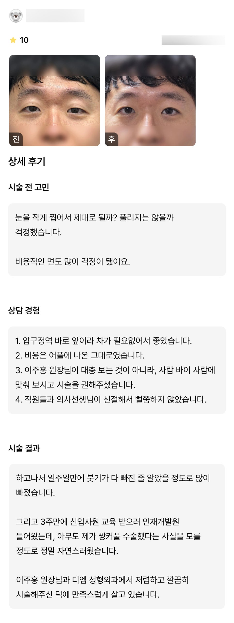 Eyelid Surgery Review. “It was so natural that no one knew I had double eyelid surgery!” image 1