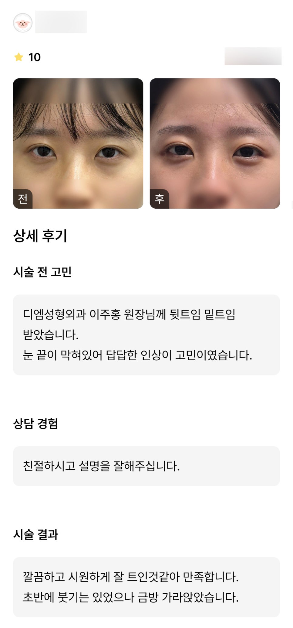 뒤밑트임 후기." 깔끔하고 시원하게 잘 트인 것 같아 만족합니다" 관련 이미지 1