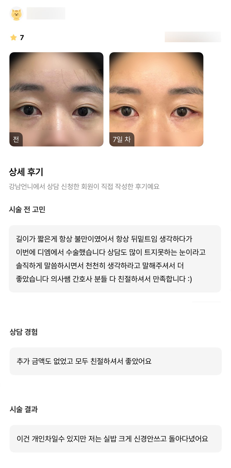 뒤밑트임 후기."솔직하게 말씀하시면서 천천히 생각하라고 말해주셔서 더 좋았습니다" 관련 이미지 1