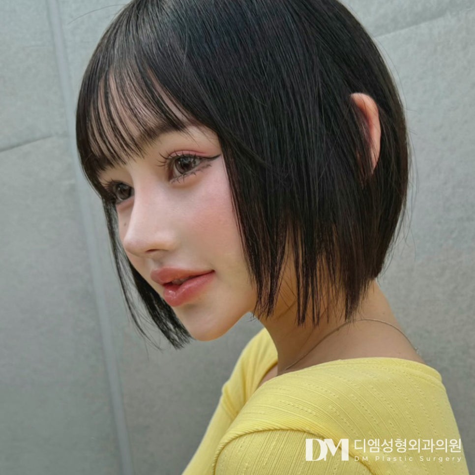 코끝성형, 뭉툭한 코가 스트레스라면?! 관련 이미지 1