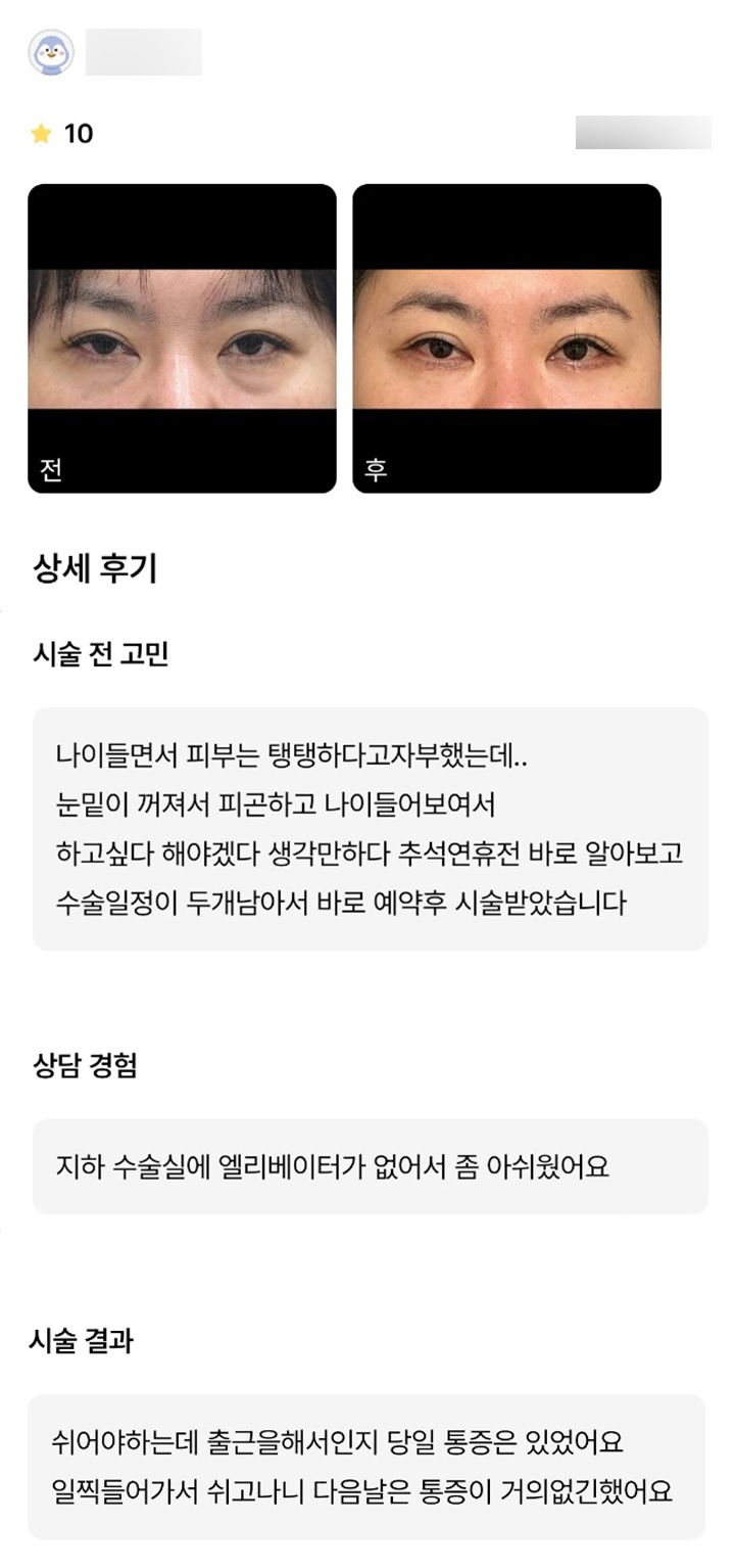 하안검 후기."통증이 거의 없어 좋았어요!" 관련 이미지 1