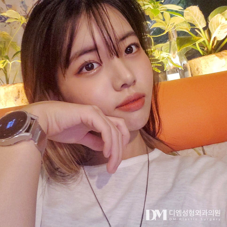 짧은코성형 하나만으로도 입체적인 얼굴로 ! 관련 이미지 11
