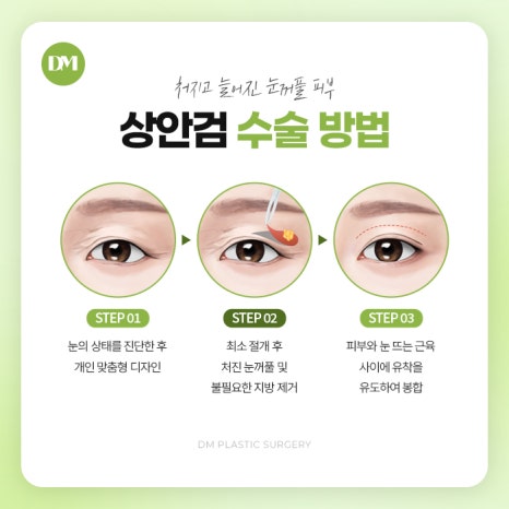 Escape Drooping Eyes and Renew Your Eye Area for a More Youthful Look image 7