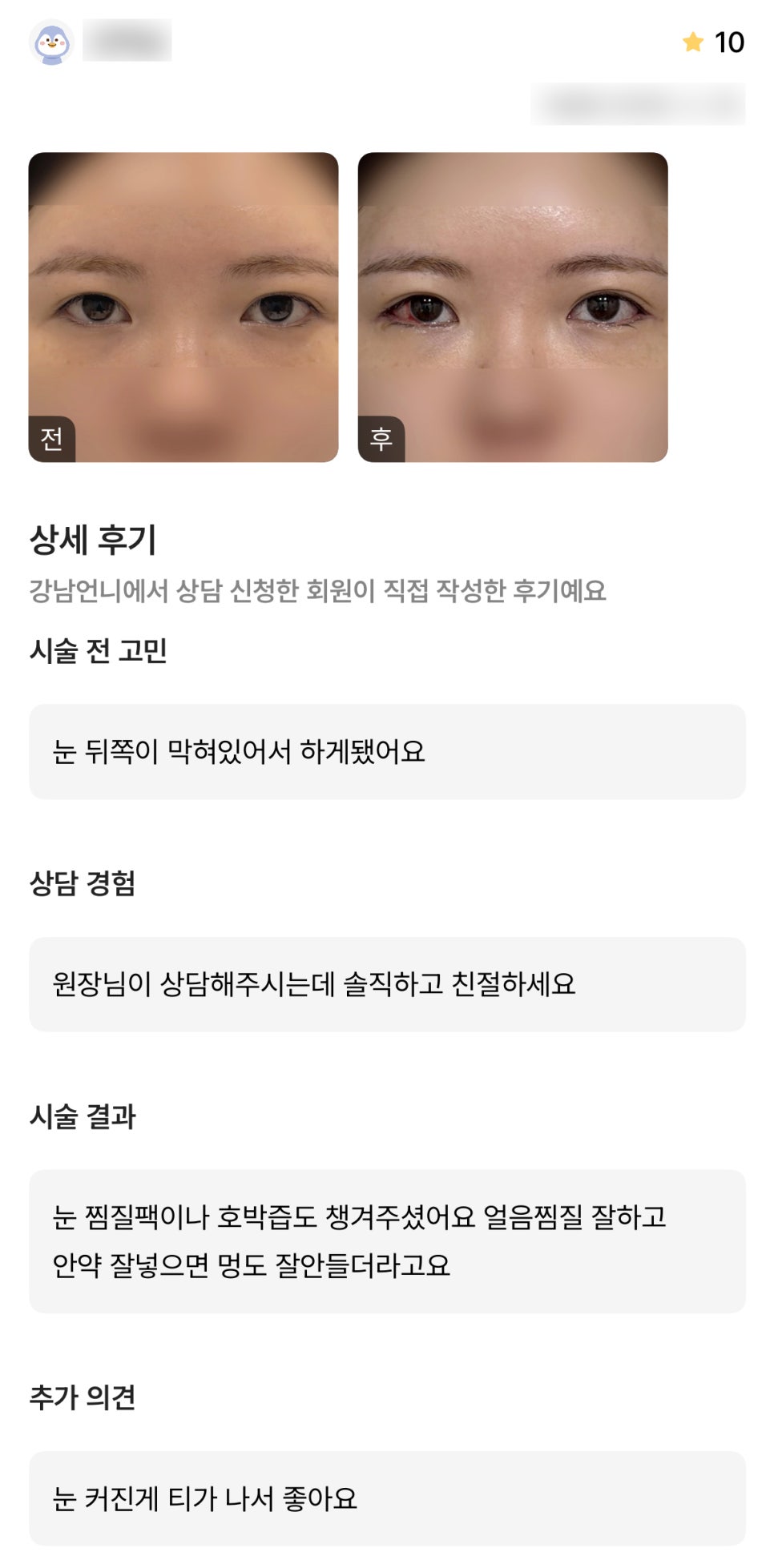 디엠 빵트임 수술후기, &ldquo;눈 커진 게 티나서 좋아요!&rdquo; 관련 이미지 1