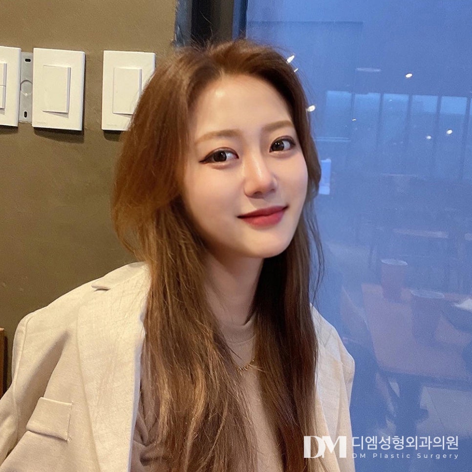 뒤밑트임, 사납거나 답답한 눈매 고민 해결 관련 이미지 9