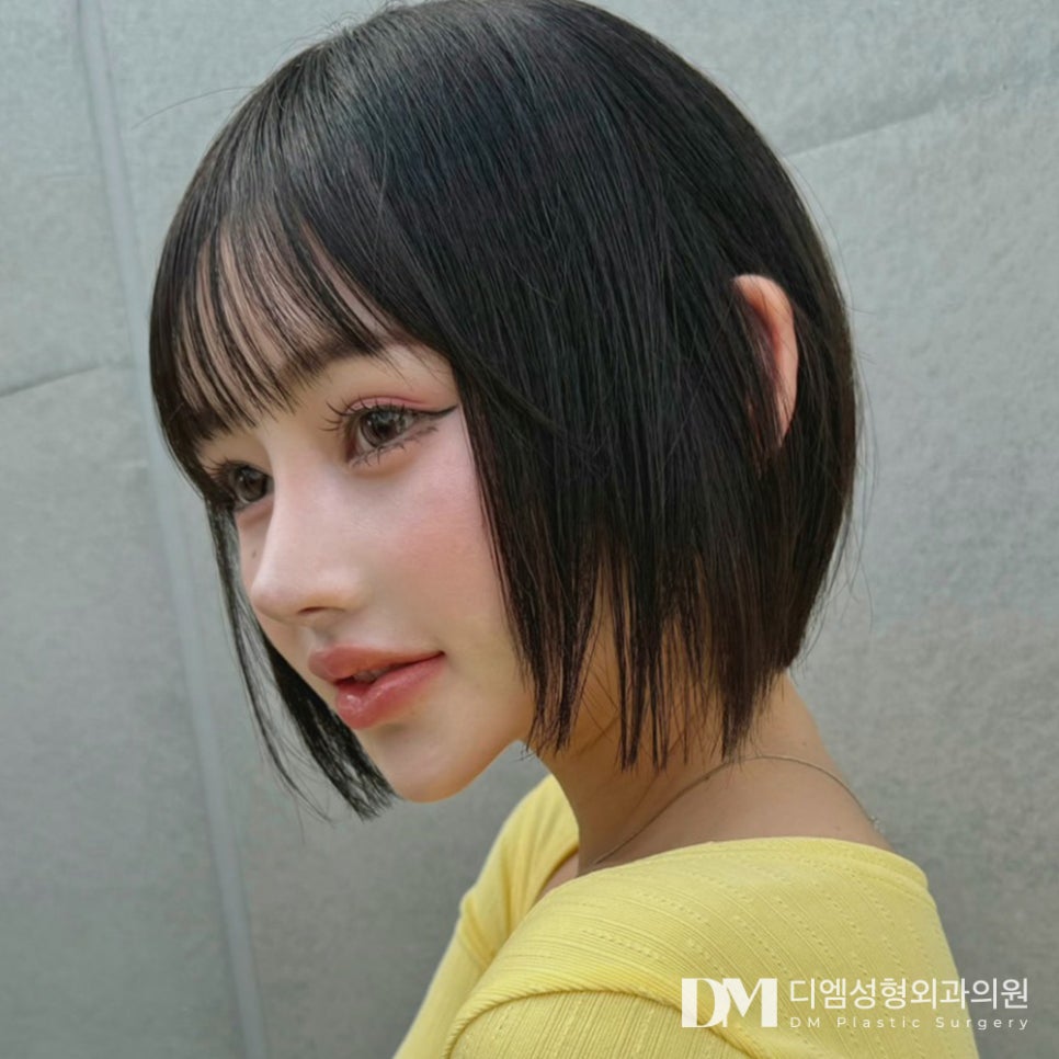 매부리코, 굴곡진 콧대가 고민이라면 관련 이미지 1