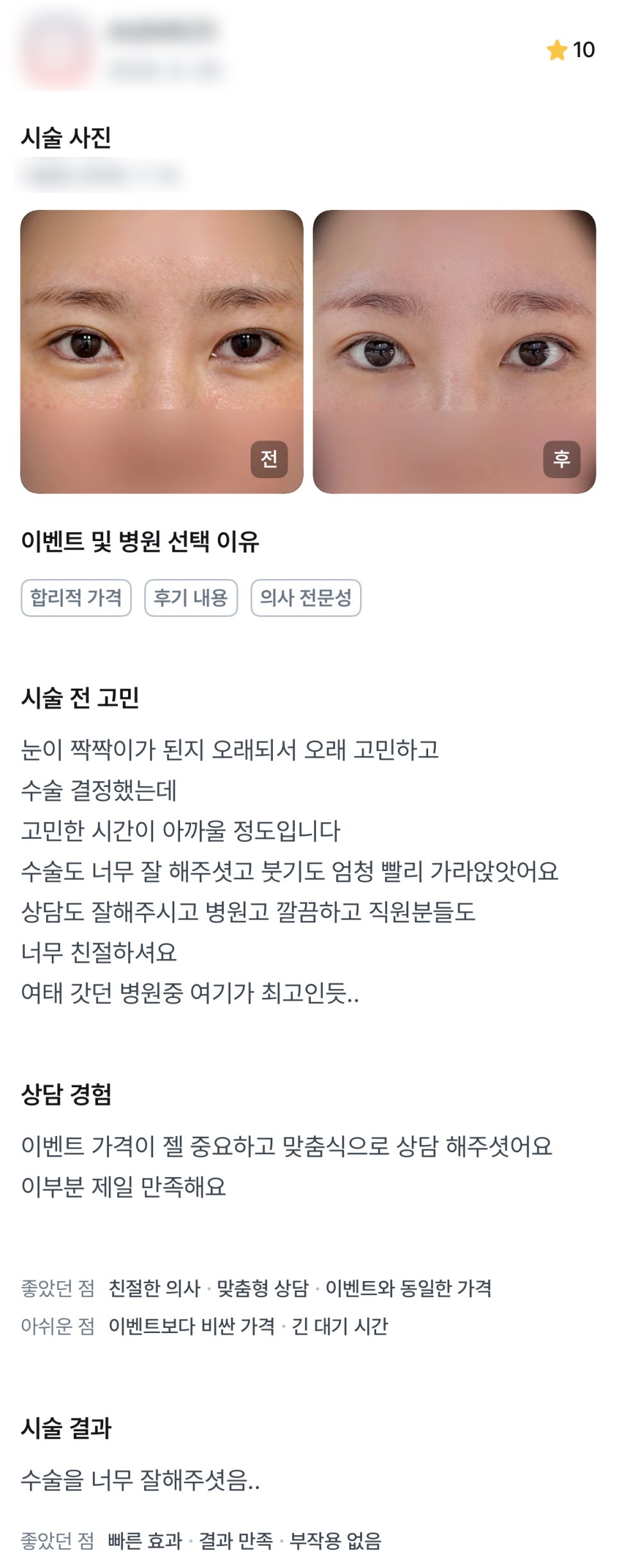 디엠 눈재수술 후기, “맞춤식 상담이어서 만족스러워요!” 관련 이미지 1