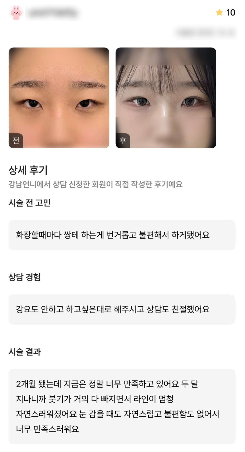 DM Eyelid Correction/Eye Plastic Surgery Review, “I’m very satisfied because the line has become incredibly natural!” image 1